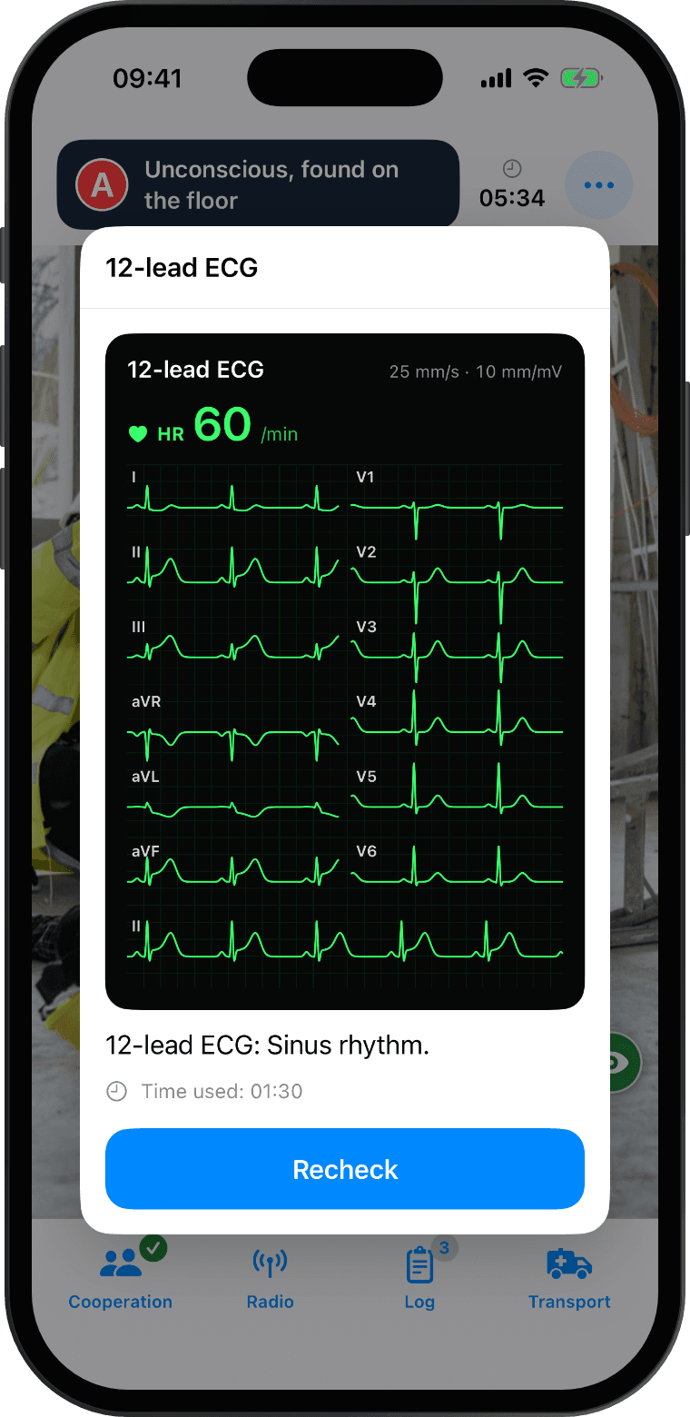 12-lead ECG on the multimonitor, with ST elevation in II, III and aVF